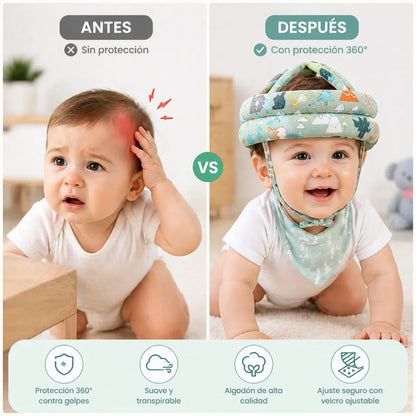 Casco Protector para Bebés
